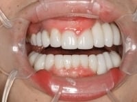 Konig Center for Cosmetic & Comprehensive Dentistry smile photos